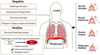 Diaphragm Dysfunction and Rehabilitation Strategy in Patients With Chronic Obstructive Pulmonary Disease